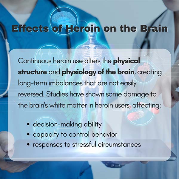 A list of effects of heroin on the brain