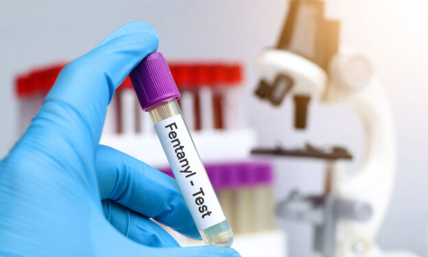 Urine samples for testing fentanyl in the laboratory, urine sample in test tube