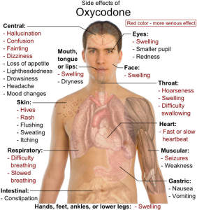 Oxycodone Addiction Symptoms